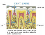 dent saine - 